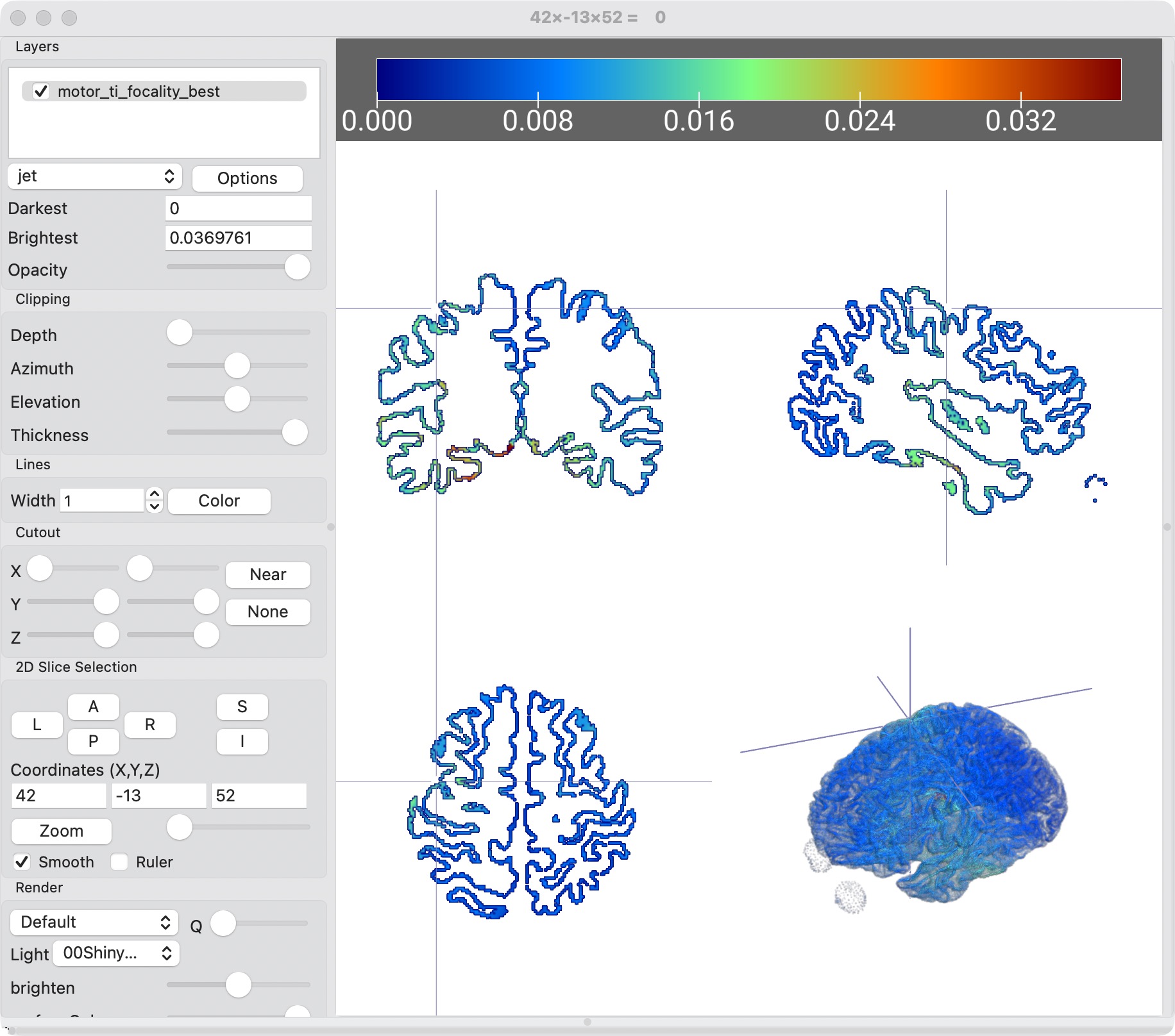 Cortical-surface visualization from a MIDA candidate-site analysis